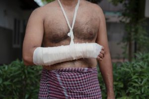 Fracture dislocation Management 2 Fracture dislocation Management